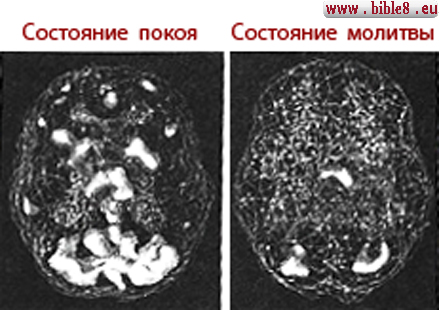 Активность мозга во время молитвы фактически исчезает , то есть она снижается в десятки раз. В состоянии бодрствования мозг взрослого человека работает примерно с частотой в 12 Гц. А во время молитвы - согласно исследованиям профессора Валерия Слезина - зафиксирована активность примерно в 3 Гц. Подобные показатели были бы характерны в случае, если бы участник эксперимента был без сознания.